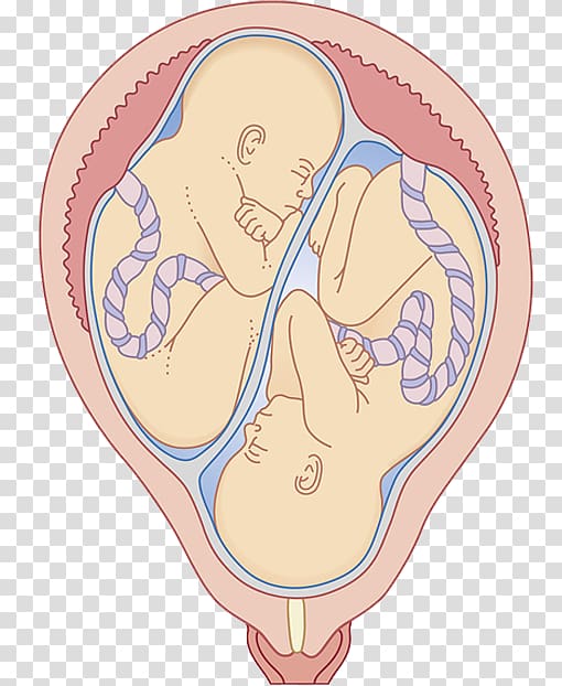 Twin Uterus Umbilical cord Pregnancy Fertilisation, Twin embryo transparent background PNG clipart