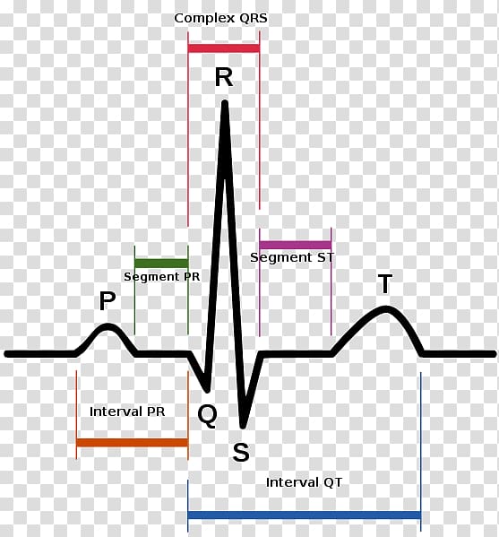 Sinus rhythm Electrocardiography Heart rate Sinus tachycardia, heart transparent background PNG clipart