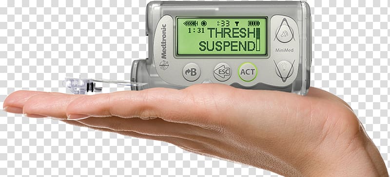 Insulin pump Minimed Paradigm Medtronic Diabetes mellitus, insulin administration transparent background PNG clipart