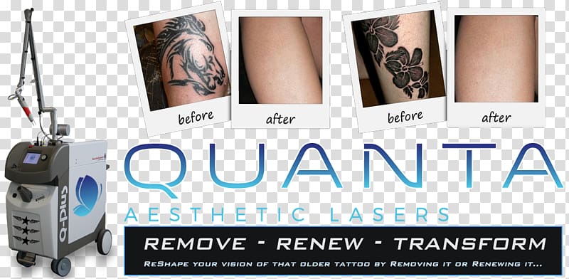 Flashpoint Tattoo Company Tattoo removal Laser Cover-up, others transparent background PNG clipart