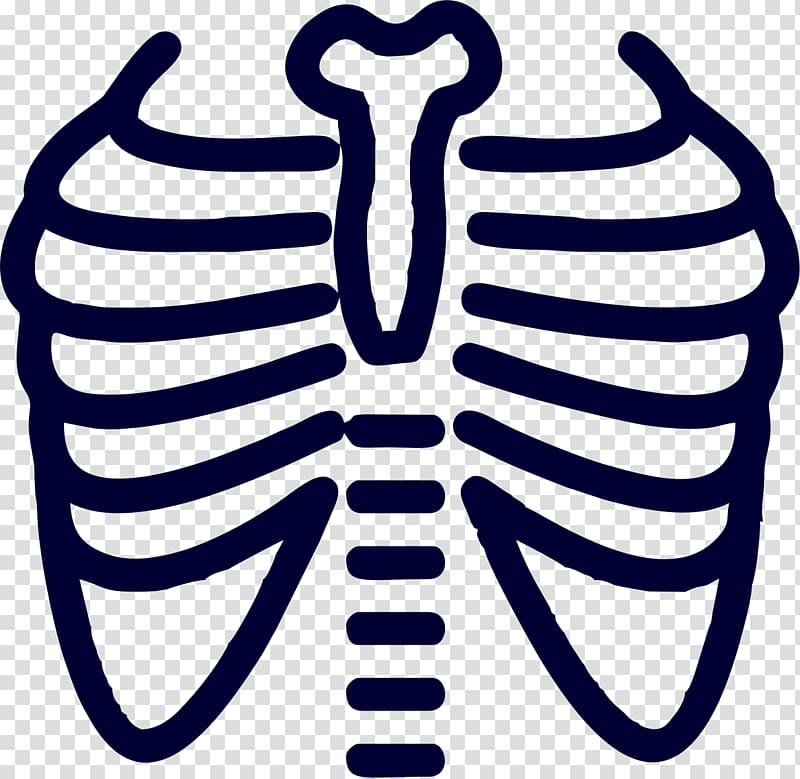 chest x ray clipart