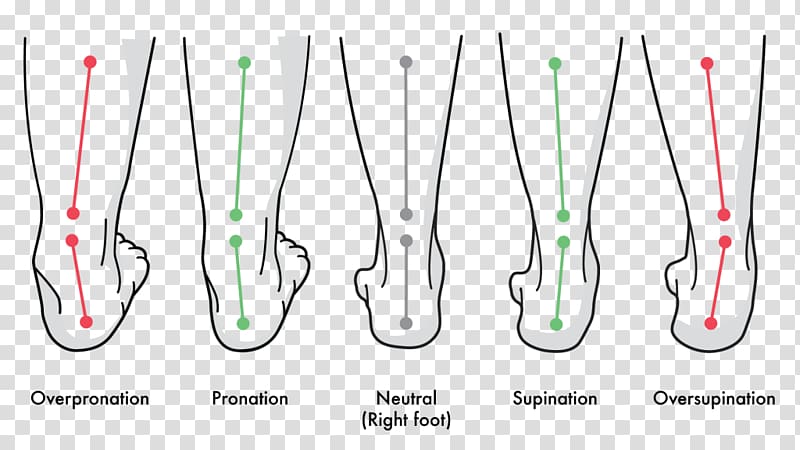 Pronation of the foot Supination Gait Achilles tendinitis, others transparent background PNG clipart