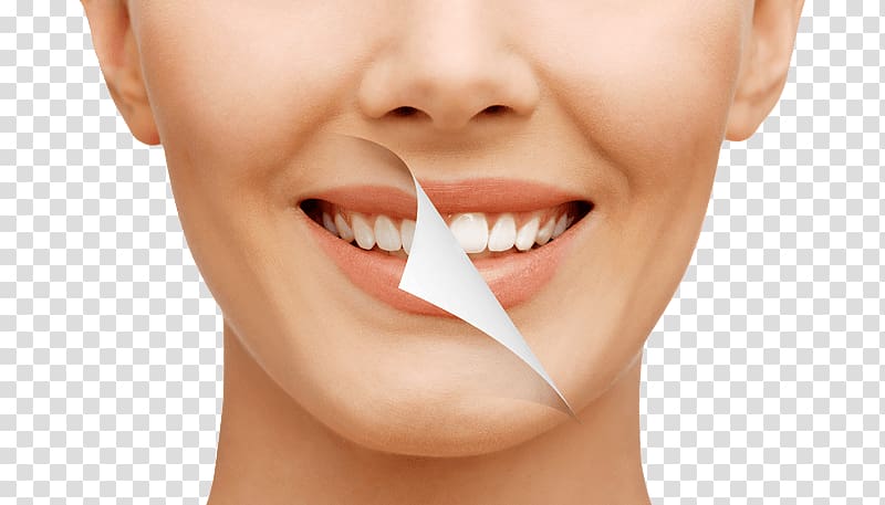 Freedom Dental Cosmetic dentistry Makeover, Smile WOMAN transparent background PNG clipart