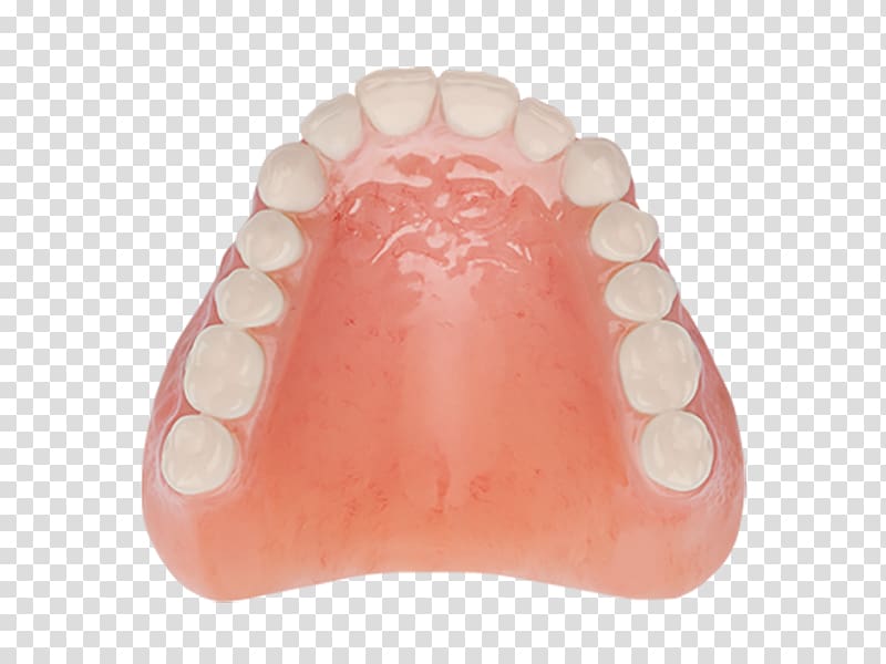 Tooth Dentures Dentistry Removable partial denture Aspen Dental, Aspen Dental transparent background PNG clipart