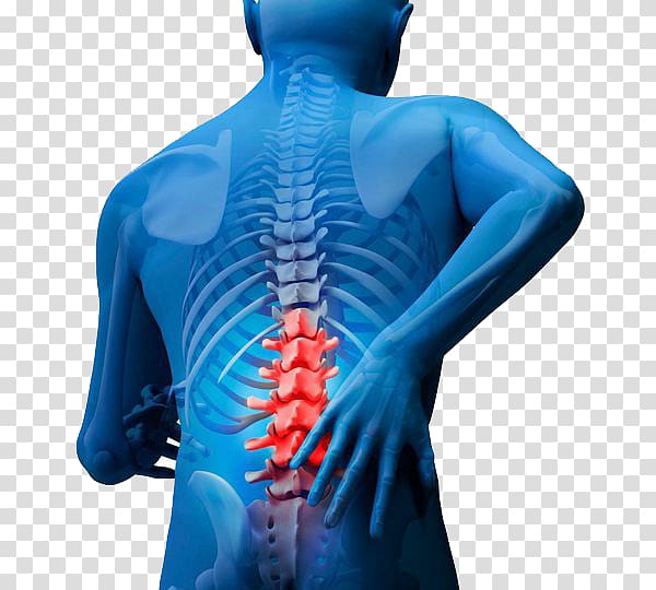 Low back pain Vertebral column Lumbar Spinal fusion, diadem transparent background PNG clipart