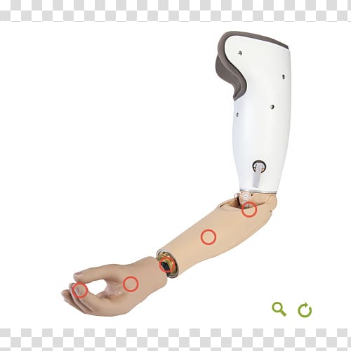 Prosthesis Orthotics Limb Arm Elbow, arm transparent background PNG clipart