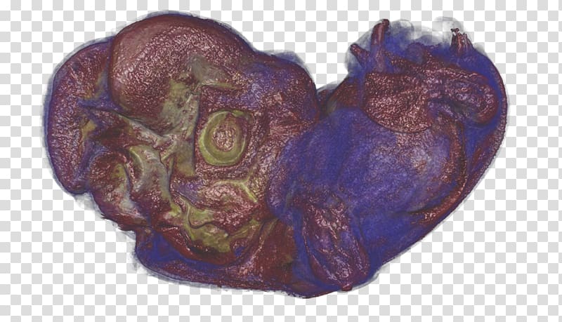 Purple Organism Heart, biomedicine transparent background PNG clipart