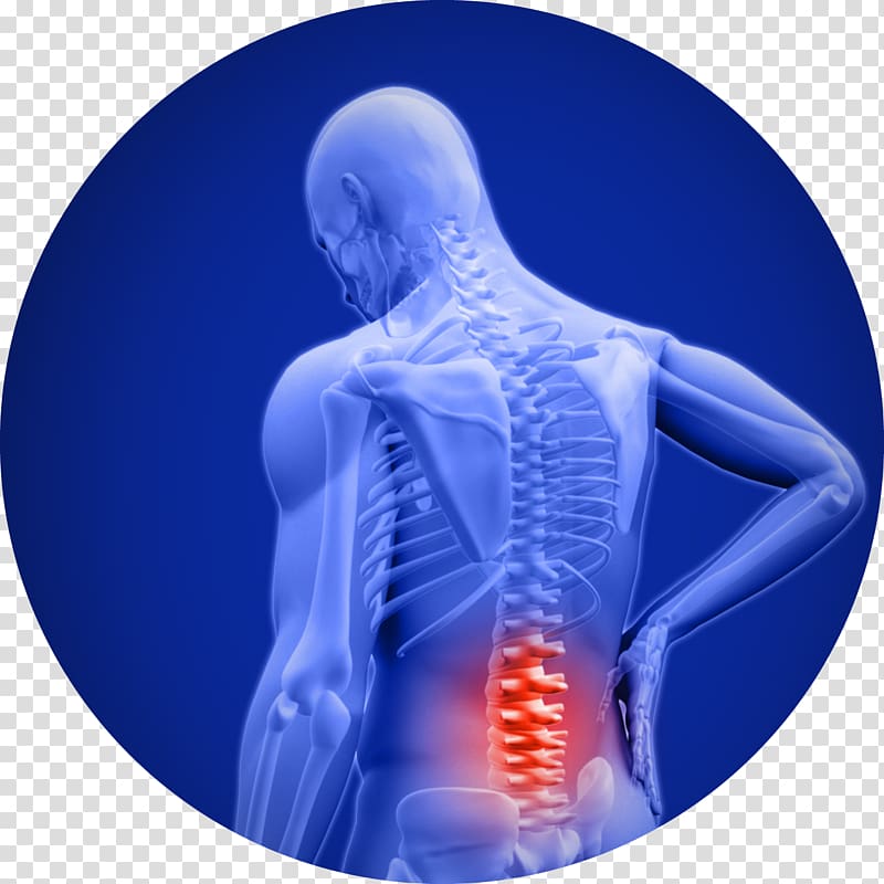 Low back pain Cody B. Doyle, D.C. Neck pain Spinal disc herniation, others transparent background PNG clipart