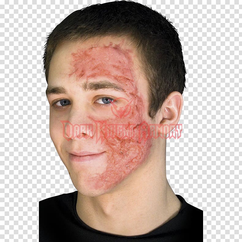 Burn scar contracture Face Scarred, Scar transparent background PNG clipart