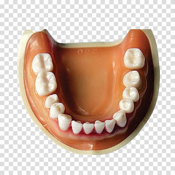 Tooth Dentures Mouth Prototype Crown, Free dentures pull material transparent background PNG clipart