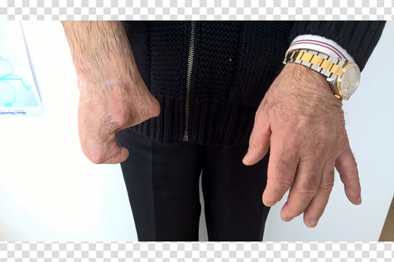Thumb Sleeve Wrist Shoulder Hip, riflesso transparent background PNG clipart