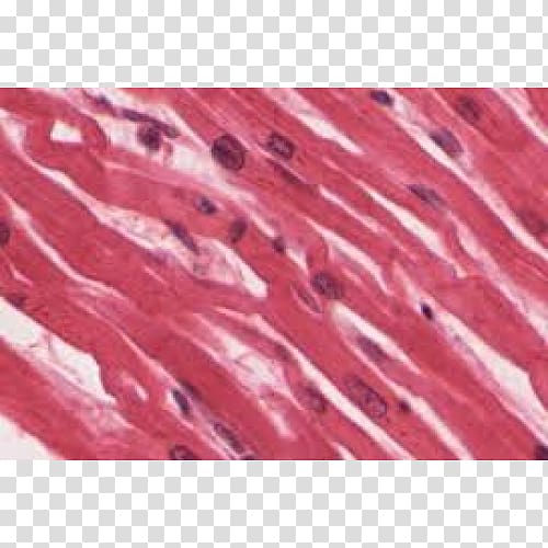 Muscle tissue Skeletal muscle Cardiac muscle Myocyte, striated transparent background PNG clipart