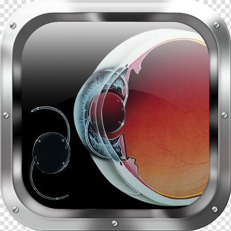 Intraocular lens Retinal detachment Cataract surgery, Eye transparent background PNG clipart