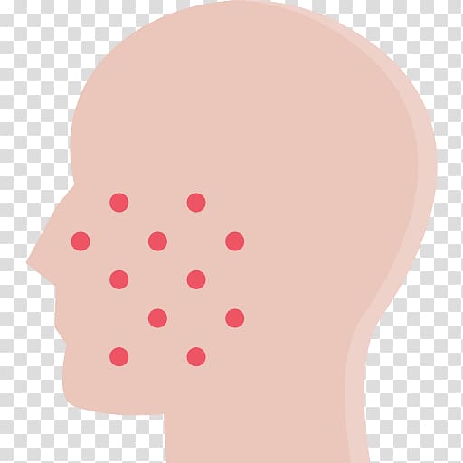 Nummular dermatitis Cheek Skin Eczema, asistencia transparent background PNG clipart