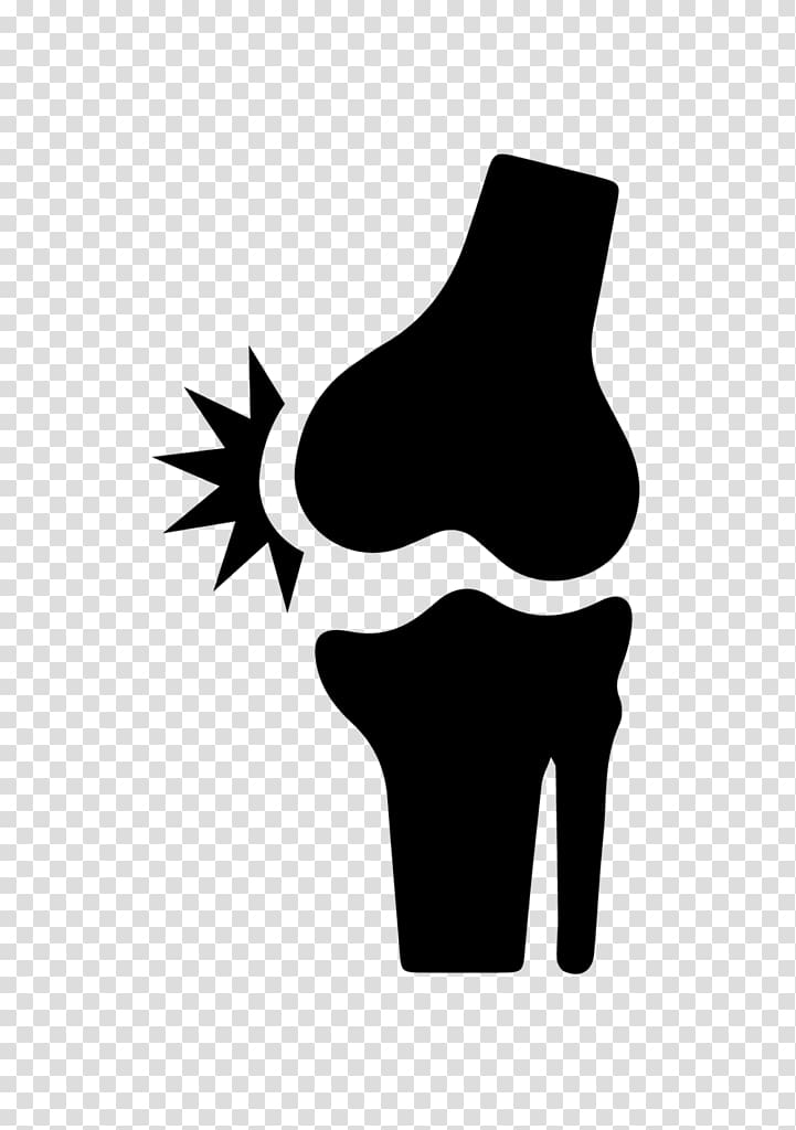 Joint pain Bone fracture Knee, Knee Pain transparent background PNG clipart