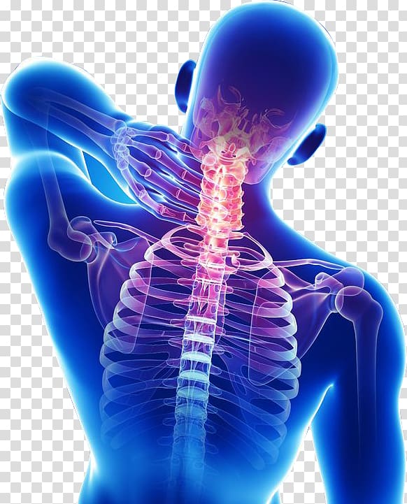 Neck pain Back pain Pain management Medicine, others transparent background PNG clipart