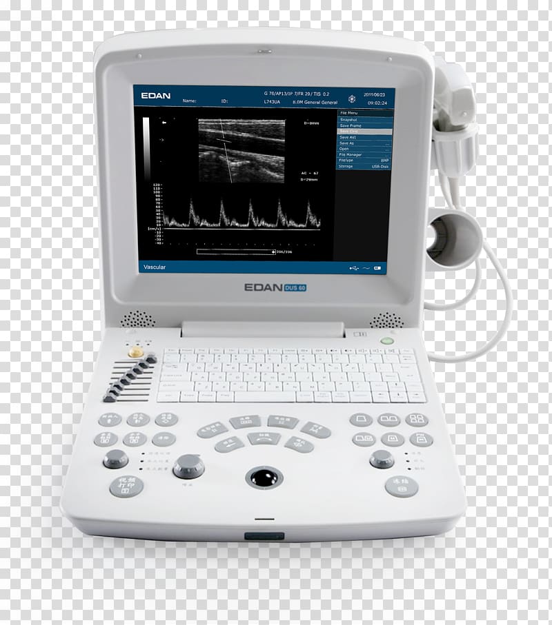 Ultrasonography Ultrasound Medical imaging Electrocardiography Mindray, others transparent background PNG clipart
