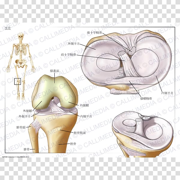 Knee Tear of meniscus Osteoarthritis 膝関節, meniscus transparent background PNG clipart