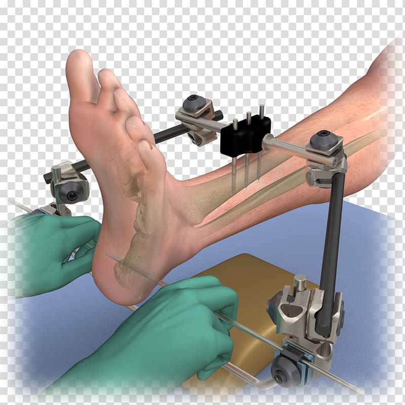 Finger Medical animation Medical glove, Marketing transparent background PNG clipart