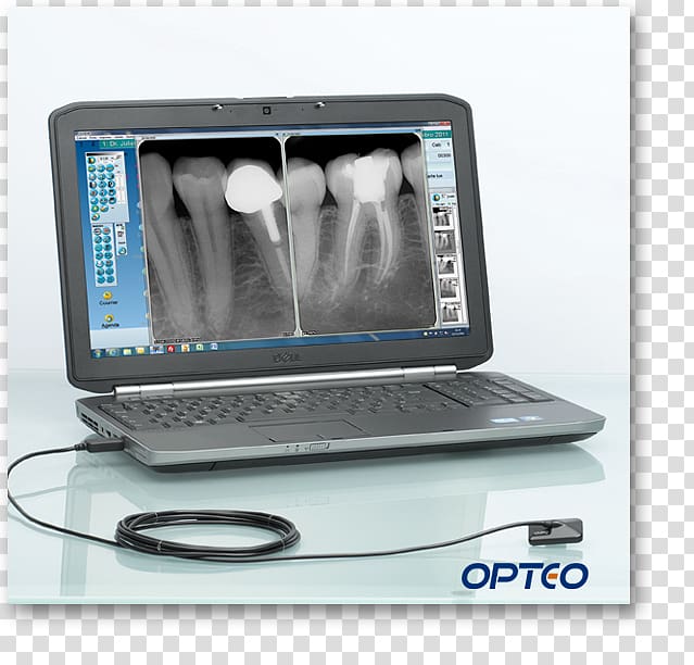 Dentistry Radiology Sensor Digital radiography Dental radiography, Dental medical equipment transparent background PNG clipart