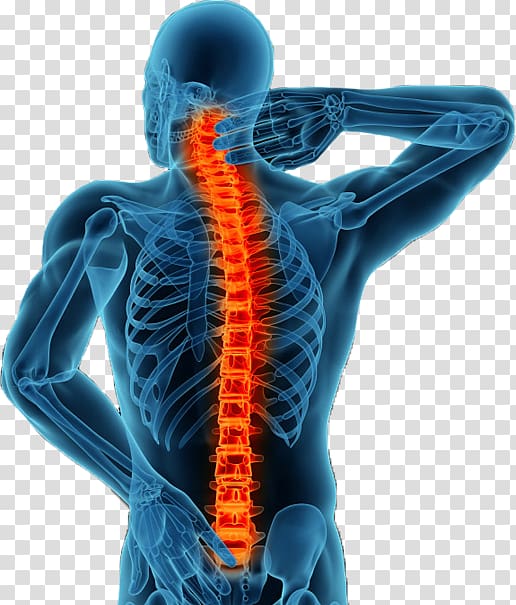 Vertebral column Minimally invasive spine surgery Spinal fusion Back pain, others transparent background PNG clipart